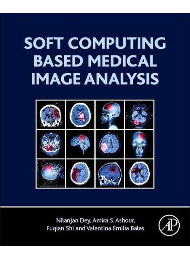 Soft Computing Based Medical Image Analysis