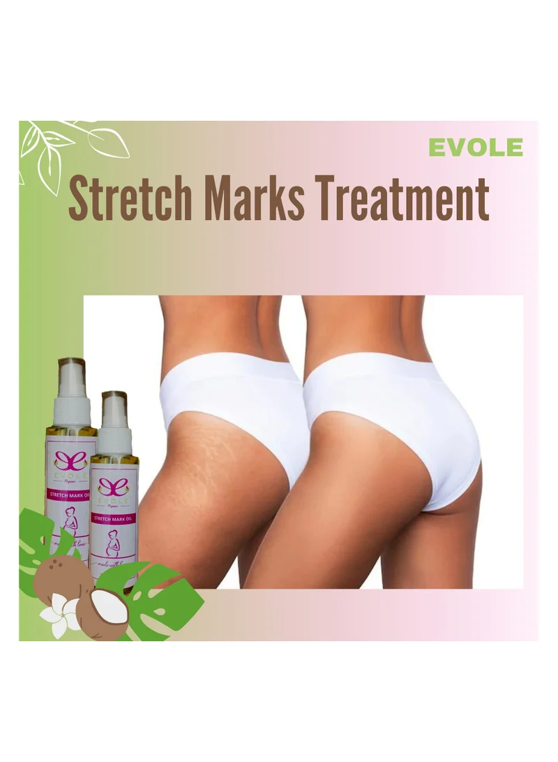 EVOLE EVOLE oil to remove stretch marks caused by pregnancy 100ml
