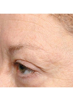 COLLISTAR FormuL.A. Eye Cream  - Image 5