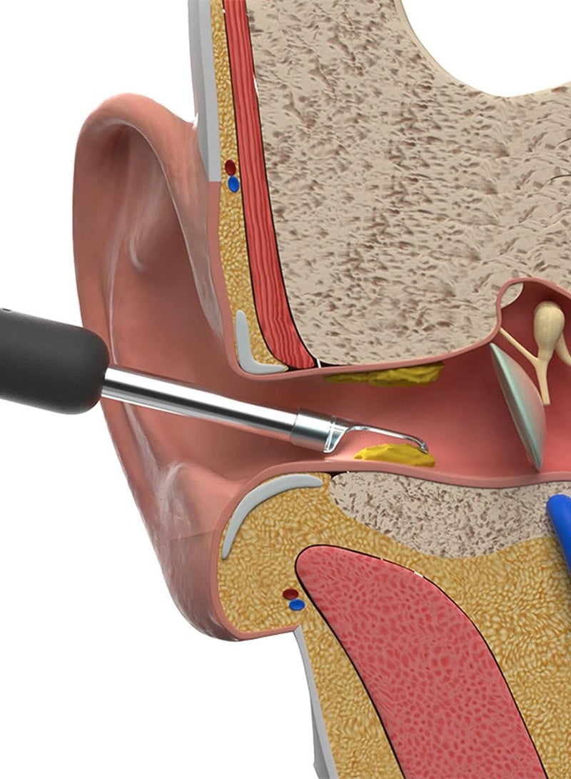 BEBIRD R1 Wireless Smart Optical Ear Cleaner Tool - Image 4