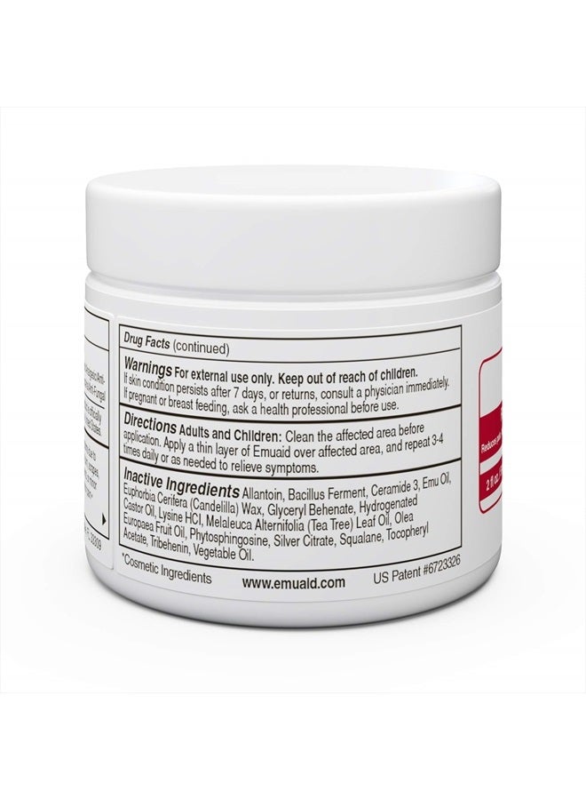 Emuaid EMUAIDMAX Ointment 2oz - Eczema Cream. Maximum Strength Treatment. Use Max Strength for Athletes Foot, Psoriasis, Jock Itch, Anti Itch, Rash and Skin Yeast Infection. - Image 2