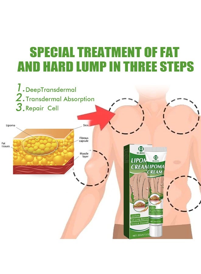 OUHOE Lipoma Cream For Unblock Various Fat Clumps In The Body - Image 4