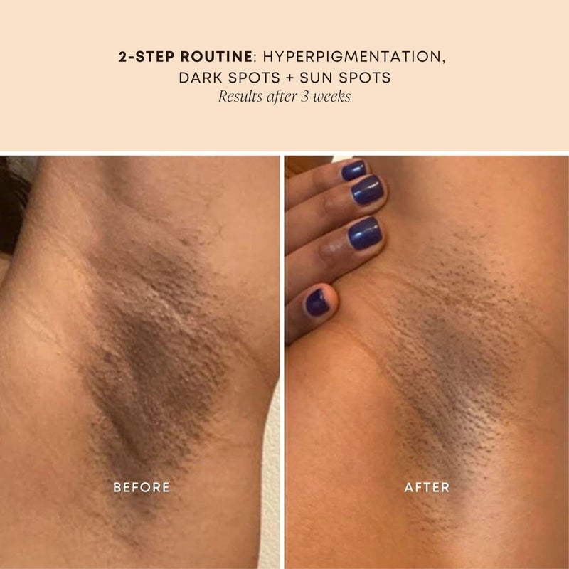 Bushbalm Dark Spot Oil - Helps Brighten and Reduce Hyperpigmentation, Razor Burn & Underarm Bumps - Soothe Skin from Post Shave Itchiness, Irritation & Redness, 30 ml - Bermuda Oil - Image 5