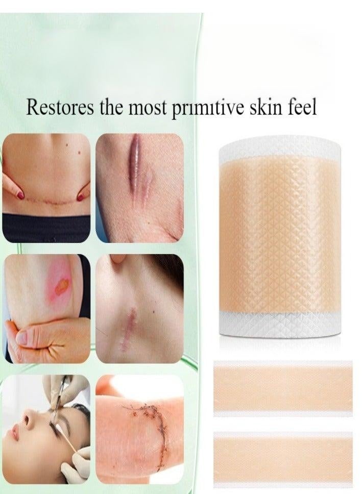 شفاء الحياة شريط ندبة سيليكون ، ورقة إزالة ندبة سيليكون طبية ، ورقة ندبة سيليكون مقاومة للماء لعلاج علامات التمدد ، لفة شريط غير مؤلمة لإزالة ندبة مستحضرات التجميل الفعالة للعملية القيصرية ، ندوب الحروق وندبات أخرى (4 سم × 1.5 م) - Image 3