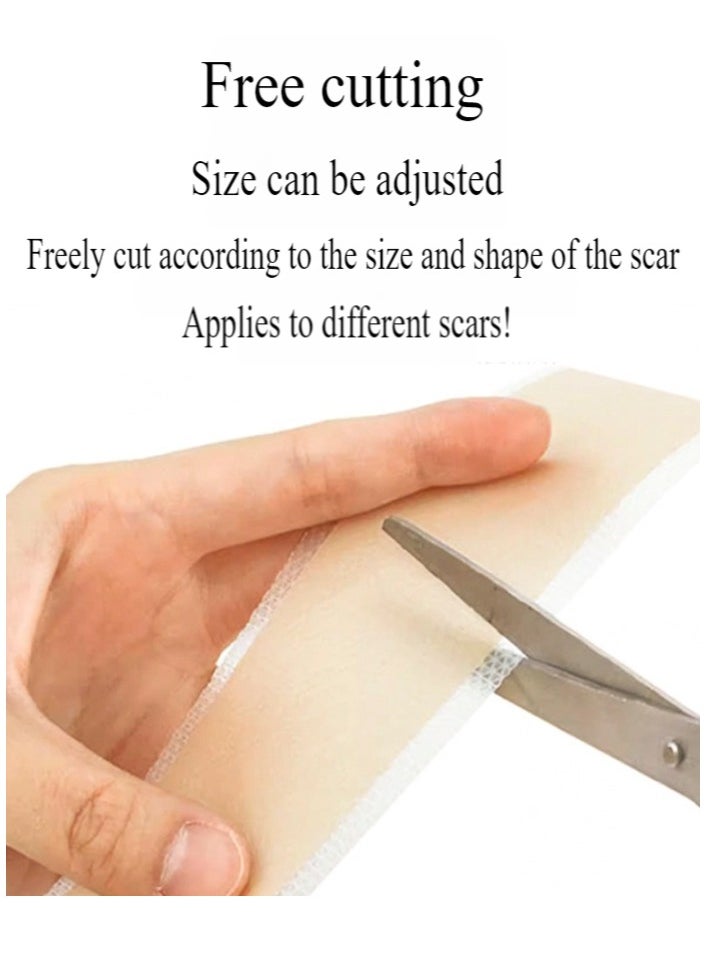Healife - Silicone Scar Tape, Medical Silicone Scar Removal Sheet, Stretch Mark Treatment Waterproof Silicone Scar Sheet, Fade Scar Effective Cosmetic Scar Removal Gel Painless Tape Roll for Cesarean Section, Burn Scars and Other Scars (4cm x 1.5m) - Image 1