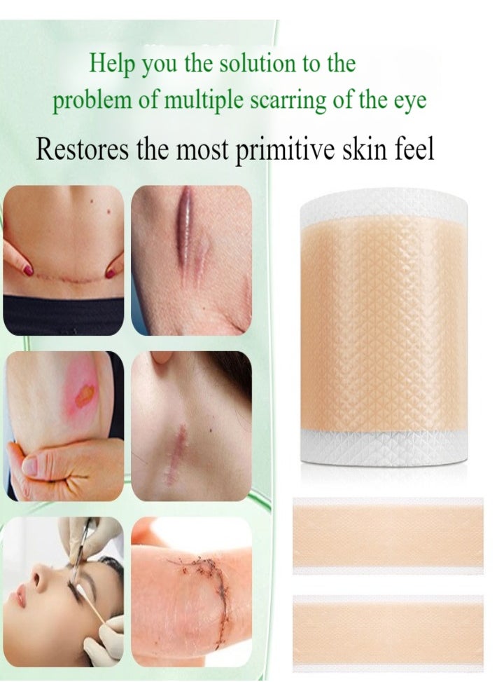 Healife - Silicone Scar Tape, Medical Silicone Scar Removal Sheet, Stretch Mark Treatment Waterproof Silicone Scar Sheet, Fade Scar Effective Cosmetic Scar Removal Gel Painless Tape Roll for Cesarean Section, Burn Scars and Other Scars (4cm x 1.5m) - Image 1