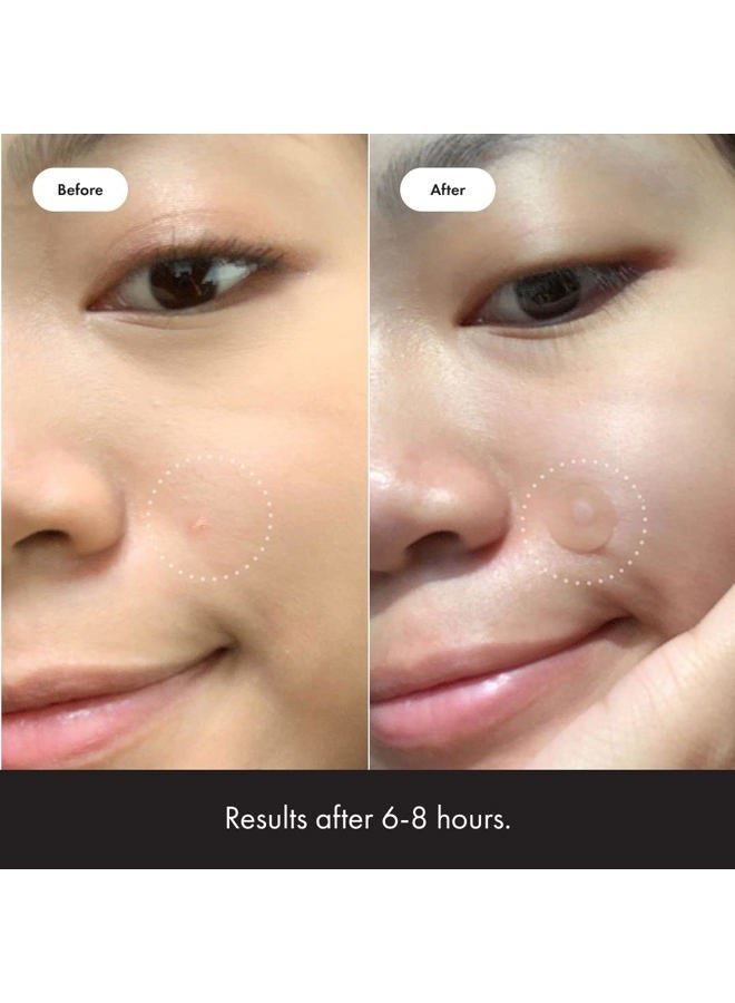 Mighty Patch ™ لاصقة أصلية من هيرو كوسميتيكس - لاصقة هيدروكوليد لعلاج حب الشباب لتغطية البثور والعيوب في الوجه والبشرة، صديقة للنباتيين ولم يتم اختبارها على الحيوانات (36 قطعة) - Image 4