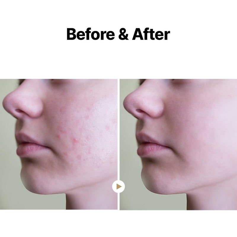 MAY COOP Raw Moisturizer Face Cream + Raw Moisture Korean Toner Pads 160ml (70 Pads) Bundle - Image 5