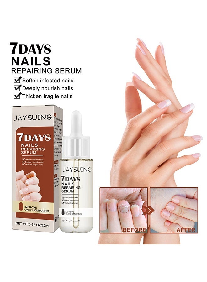 Jaysuing 7Days Nails Repairing Serum, Nail Nutrient Oil Strengthener Oil Serum Nail Growth Oil, Nail Cuticle Oil Strengthener, Nail Serum For Growth And Repair For Damaged Nails, 20ML - Image 1