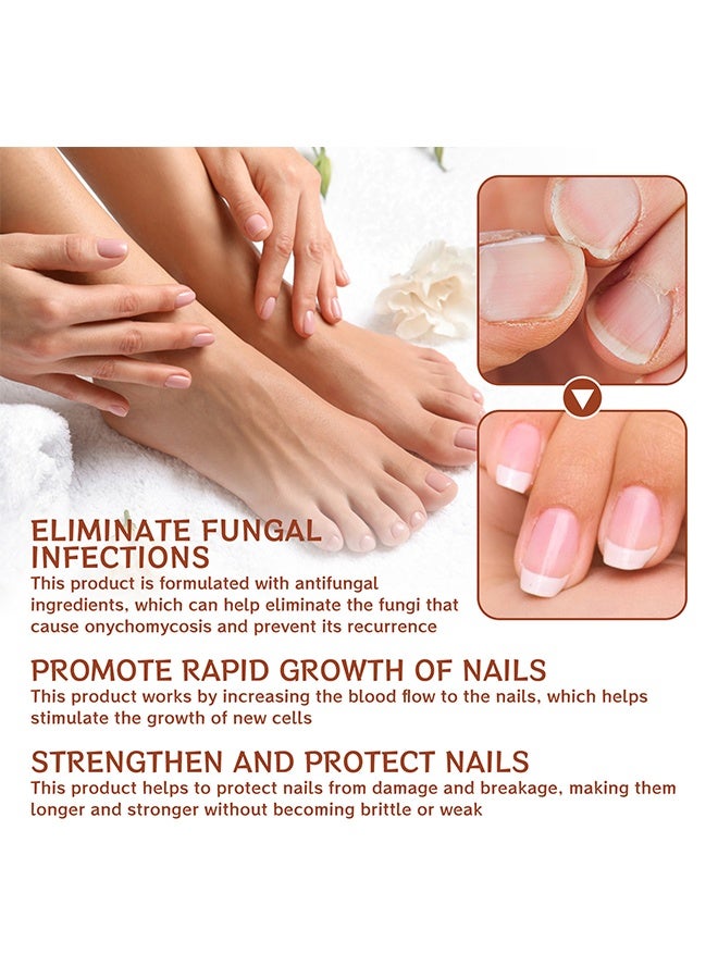 Jaysuing 7Days Nails Repairing Serum, Nail Nutrient Oil Strengthener Oil Serum Nail Growth Oil, Nail Cuticle Oil Strengthener, Nail Serum For Growth And Repair For Damaged Nails, 20ML - Image 4