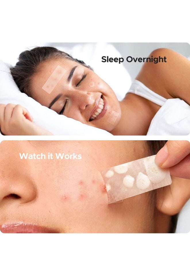 FASHION MANIA Large Pimple Patches, 7 Sizes XL Acne Patches for Body, Chin, Forehead - Image 3