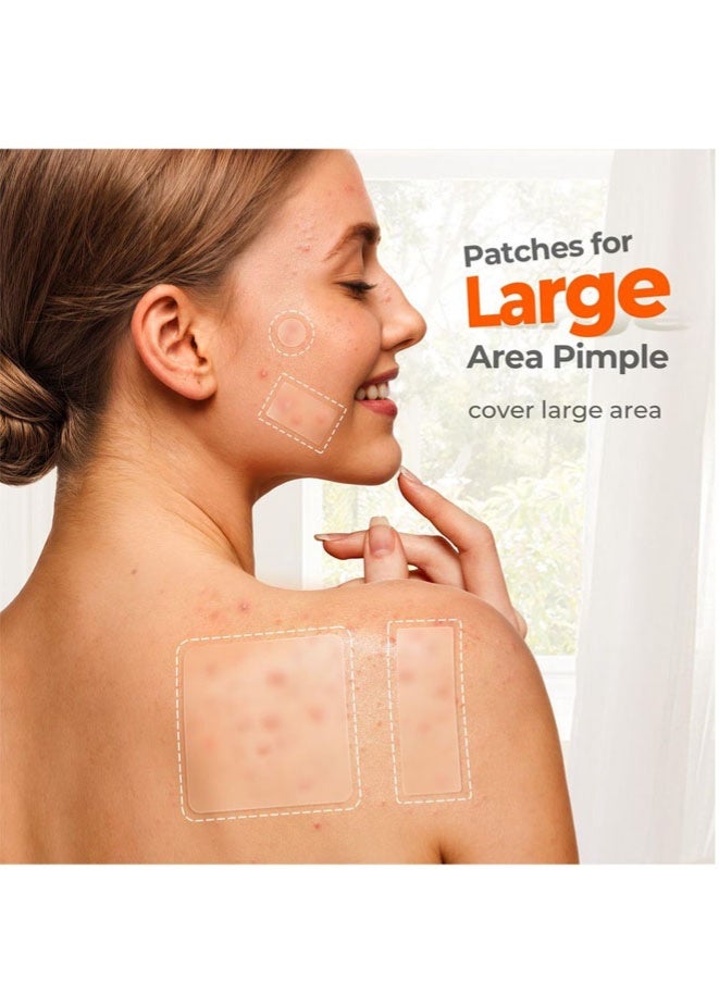 FASHION MANIA Large Pimple Patches, 7 Sizes XL Acne Patches for Body, Chin, Forehead - Image 2