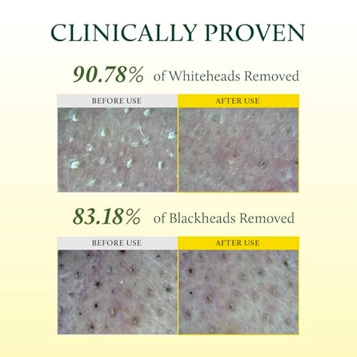 YADAH Cactus Pore Deep Cleansing Oil (6.76 Fl Oz) – Lightweight Daily Facial Cleanser & Daily Makeup Remover with Cactus Seed Oil for Pore Purifying & Balanced Skin, Double Cleansing Korean Skincare - Image 4