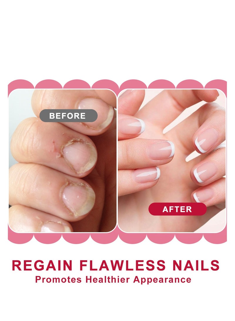 سوميفون كريم تنعيم بشرة الأظافر، الجلد الميت للأظافر، كريم تنعيم، أظافر الأصابع، كريم إصلاح، مانيكير 20 جرام - Image 2