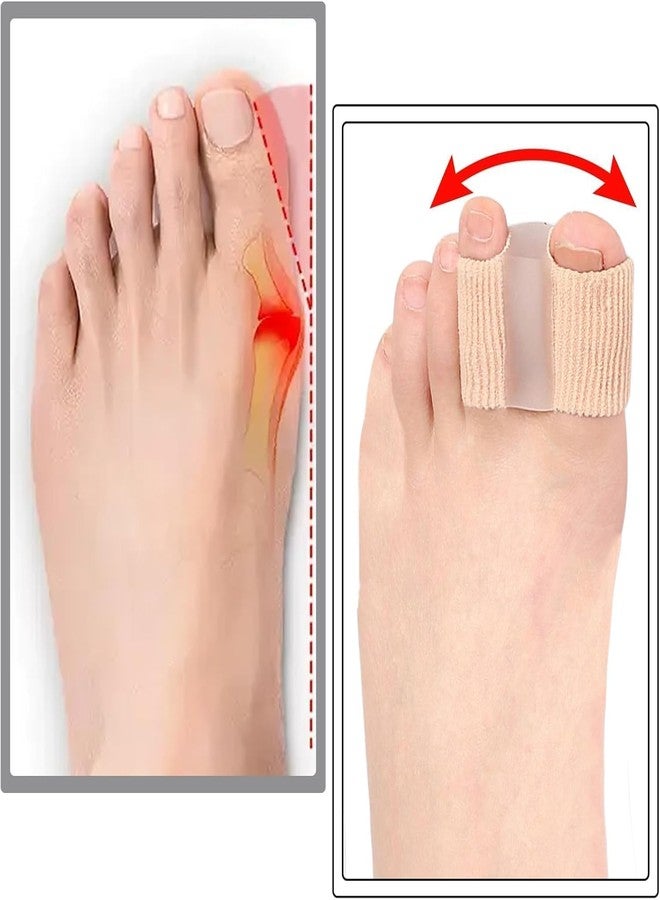 Gopendra Gel Toe Separators for Bunions – Breathable Fabric Toe Spacers with Gel Lining for Bunion Pain Relief & Hammer Toe Correction – 2-Loop Design for Men & Women (S-1 Pcs + L-1 Pcs) - Image 5