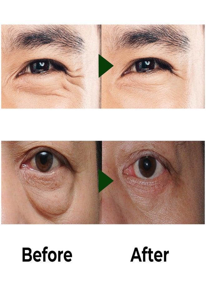 Abera Eye Roller Serum for Men - Eye Bags, Dark Circles & Puffiness Treatment - Mint Essence with Vitamin C & Peptides 0.34 fl oz 3 Box - Image 5