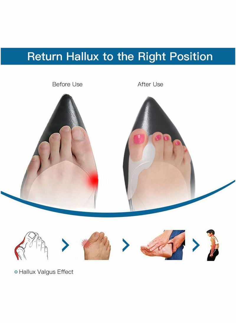 KASTWAVE - Gel Toe Big Separators Bunion Corrector Bunion Splint Hammer Toe Straightener Hallux Valgus Pain Relief 1 Pair - Image 1
