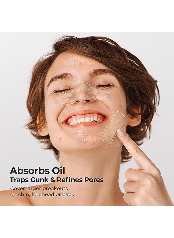 جي دي 364 قطعة من رقعة حب الشباب، 6 أحجام من رقعة حب الشباب الغروانية المائية المتنوعة، للخدود والجبهة والذقن والأنف - Image 3