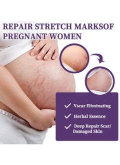 HBESTY Silicone Scar Gel, Scar Cream, Scar Gel, Acne Scar Treatment, Deep Acne Scar Removal, Burns Keloids Hypertrophic, Scar Removal Cream, Repair Damaged Skin, Removing Acne Marks, Scar Repair Cream  - Image 2