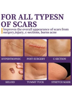 HBESTY Silicone Scar Gel, Scar Cream, Scar Gel, Acne Scar Treatment, Deep Acne Scar Removal, Burns Keloids Hypertrophic, Scar Removal Cream, Repair Damaged Skin, Removing Acne Marks, Scar Repair Cream  - Image 4