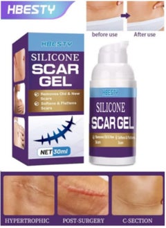 HBESTY Silicone Scar Gel, Scar Cream, Scar Gel, Acne Scar Treatment, Deep Acne Scar Removal, Burns Keloids Hypertrophic, Scar Removal Cream, Repair Damaged Skin, Removing Acne Marks, Scar Repair Cream  - Image 1