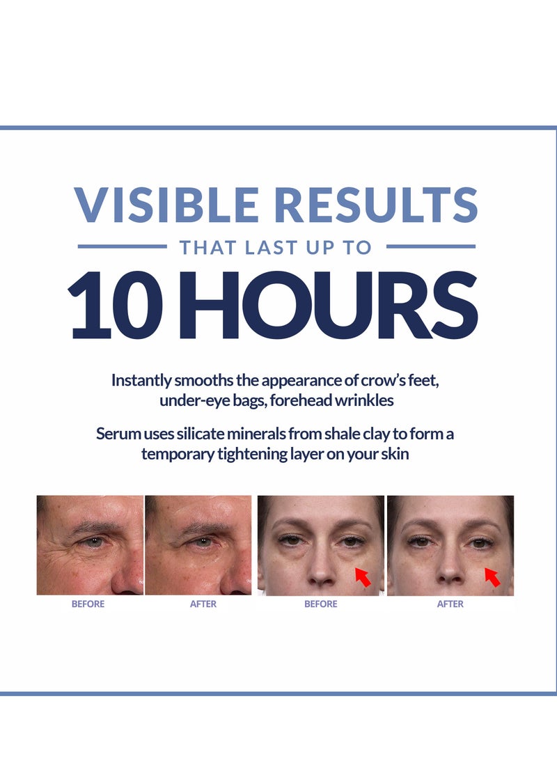 Plexaderm - Rapid Reduction Eye Serum - Advanced Formula Anti Aging Visibly Reduces Under-Eye Bags, Wrinkles, Dark Circles, Fine Lines & Crow's Feet Instantly Instant Wrinkle Remover for Face - Image 1