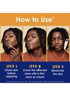 Clearasil Clearasil Stubborn Acne Control 5in1 Spot Treatment Cream, Maximum Strenght with 10% Benzoyl Peroxide, Acne Medication, 1 oz  - Image 4
