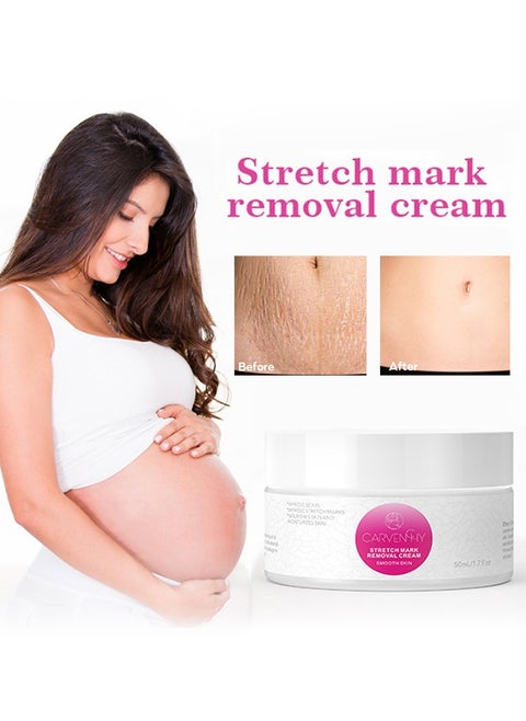 Stretch Mark Removal Cream - Fat Marks,Stretch Marks Firming Repair Cream 50M