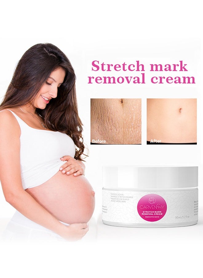 CARVENCHY - Stretch Mark Removal Cream - Fat Marks,Stretch Marks Firming Repair Cream 50M - Image 1