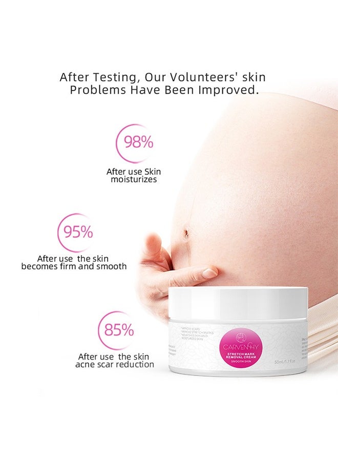 CARVENCHY - Stretch Mark Removal Cream - Fat Marks,Stretch Marks Firming Repair Cream 50M - Image 1