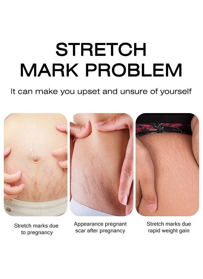 CARVENCHY - Stretch Mark Removal Cream - Fat Marks,Stretch Marks Firming Repair Cream 50M - Image 1