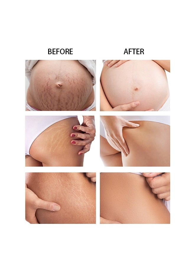 CARVENCHY - Stretch Mark Removal Cream - Fat Marks,Stretch Marks Firming Repair Cream 50M - Image 1