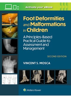 Foot Deformities and Malformations in Children: A Principles-Based, Practical Guide to Assessment and Management: Print + eBook with Multimedia 