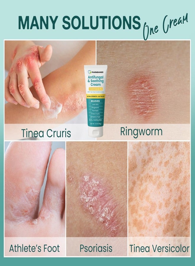 PHARMBANNER Antifungal Cream for Jock Itch, Ringworm, Psoriasis & Athlete’s Foot - Extra Strength Relief for Itchy, Burning Skin - Fast-Acting Formula for Tinea Cruris, Tinea Versicolor & Skin Irritations - Image 3
