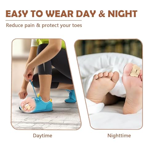 Anzailala 2pcs Hammer Toe Corrector for Women & Men, Reusable Fabric Hammer Toe Straightener for Broken Toes, Hammer Toe Splint Protector with Cushion Bandage - Image 5
