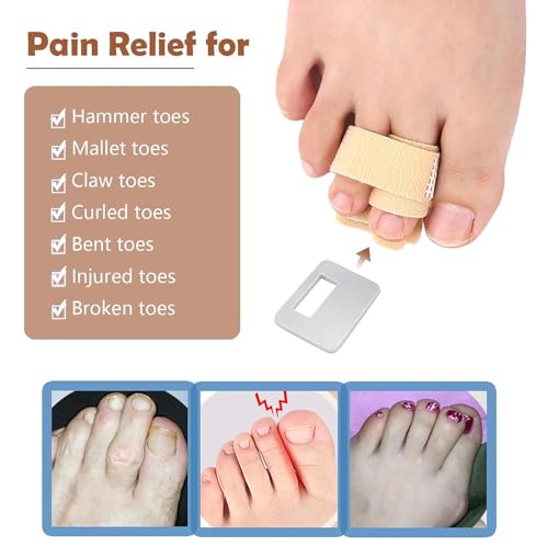 Anzailala 2pcs Hammer Toe Corrector for Women & Men, Reusable Fabric Hammer Toe Straightener for Broken Toes, Hammer Toe Splint Protector with Cushion Bandage - Image 3