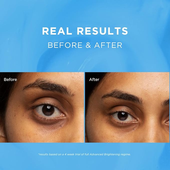 Fade Out Advanced Even Skin Tone Day Cream with SPF25 Face Cream With Niacinamide and Lactic Acid to Brighten Skin tone in 4 weeks - Image 4