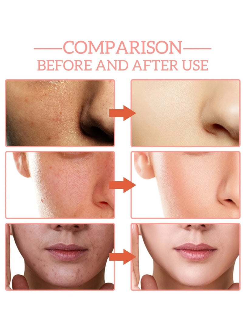 Jaysuing Facial Serum, Hydrating Collagen Facial Serum, 5 In 1 Moisturizing Whitening Serum, Facial Serum With Hyaluronic Acid And Niacinamide, Fast Absorbing Dark Spot Corrector Serum For Age Defying Beauty  - Image 4