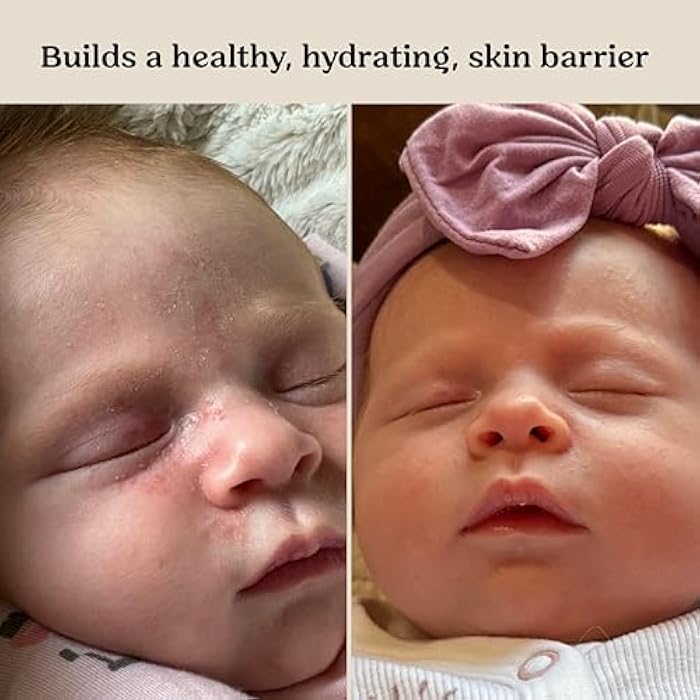 Roe Wellness- Baby Serum Hydrating Skincare EWG Verified Non-Toxic Ingredients Probiotic Protection | Hydrate, Soothe, Safe For All Skin Babies, Infants, Toddlers & Kids (Power Serum) - Image 5