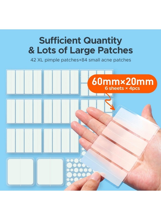 تي كيه تي كيه رقعة كبيرة لعلاج حب الشباب من تي كي تي كيه، 7 مقاسات XL، ضمادات كبيرة من الهيدروكولويد للجسم والذقن والجبهة والصدر والظهر، رقعة هيدروكولويد (شريط، مربع، نقطة، 126 رقعة) - Image 2