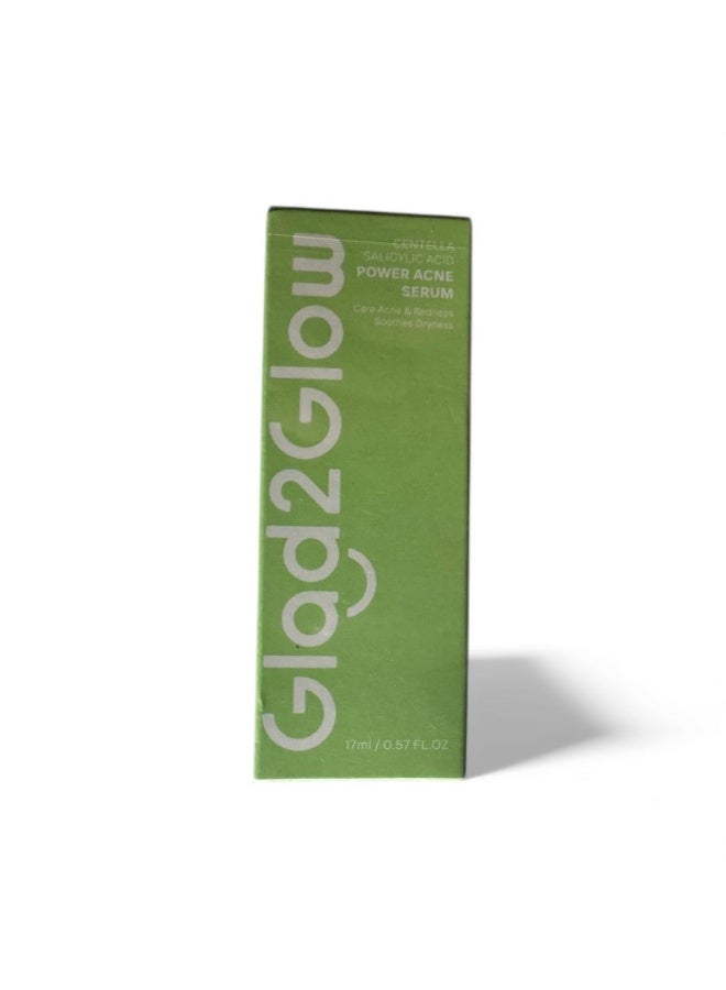 Power acne serum 17ml by glad 2 glow