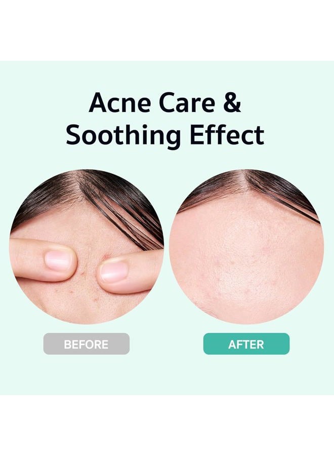 BRING GREEN [LIMITED EDITION INSPIRED BY SQUID GAME] – Netflix's exclusive Squid Game brand makes this Zinc Teak Serum a standout choice for both com fans - Image 4