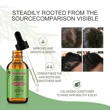 wachinas زيت إكليل الجبل لنمو الشعر مع جهاز تدليك لفروة الرأس زيت إكليل الجبل لتغذية فروة الرأس 100% طبيعي للنساء والرجال - Image 4