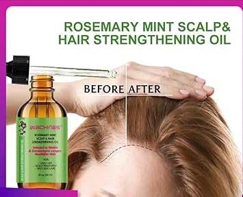 wachinas زيت إكليل الجبل لنمو الشعر مع جهاز تدليك لفروة الرأس زيت إكليل الجبل لتغذية فروة الرأس 100% طبيعي للنساء والرجال - Image 5