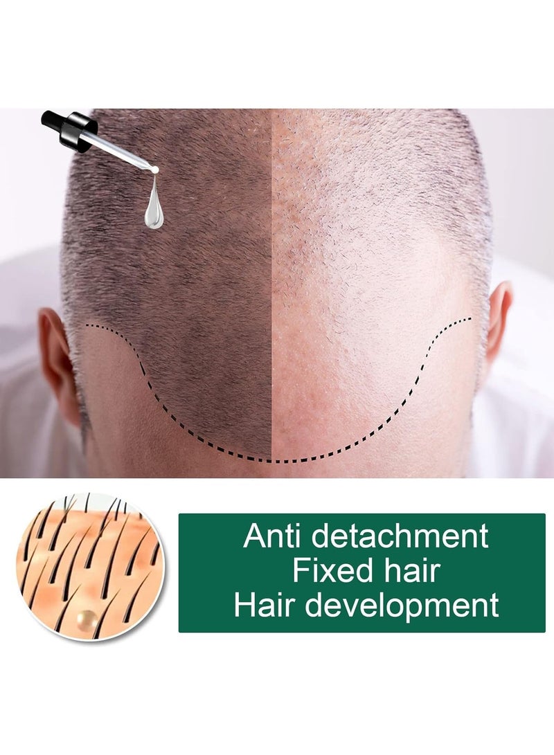 EELHOE Ginger Hair Growth Product Natural Hair Loss Prevention Treatment Fast Growth Nourishing Dry Damaged Hair Care - Image 3