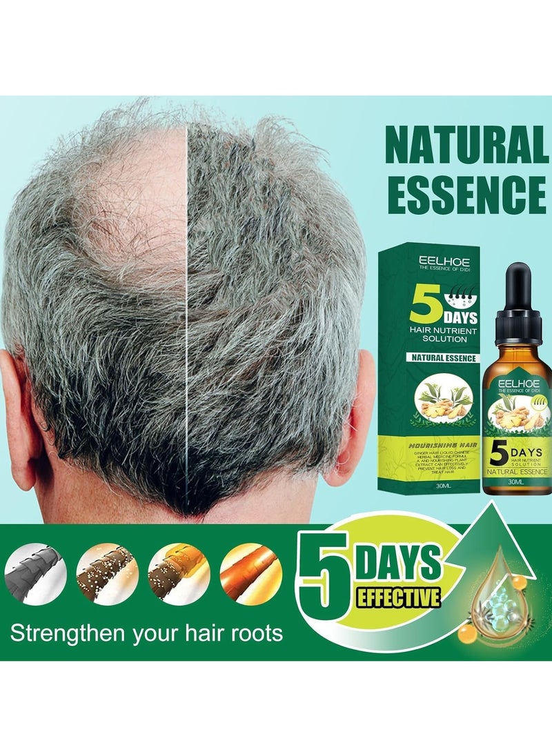 EELHOE - Ginger Hair Growth Product Natural Hair Loss Prevention Treatment Fast Growth Nourishing Dry Damaged Hair Care - Image 1