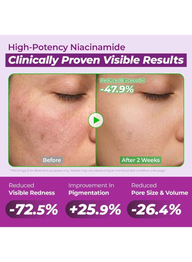 JUMISO Niacinamide 10 Serum 30ml – Pore Minimizing Dark Spot Reducer Face Serum for Oily & Combination Skin - Image 3