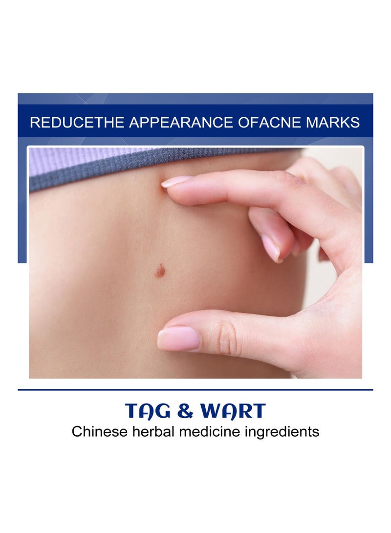 EELHOE 20g Warts Remover Cream Extract Skin Face Tag Extract Corn Treatment Ointment Painless For Men Women Childrens 100g each (Pack Of 2) - Image 3