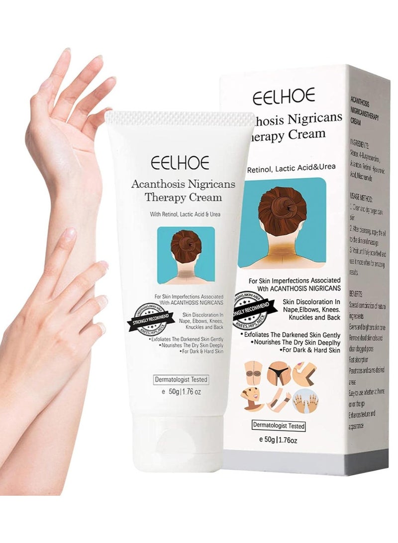 EELHOE كريم علاج الأكزنتوزيس نيغريكانس، كريم تصحيح البقع الداكنة، كريم ريتينول، كريم نيجريفيكس مع حمض اللاكتيك، إزالة فرط التصبغ للأجزاء الداكنة من الجسم - Image 2