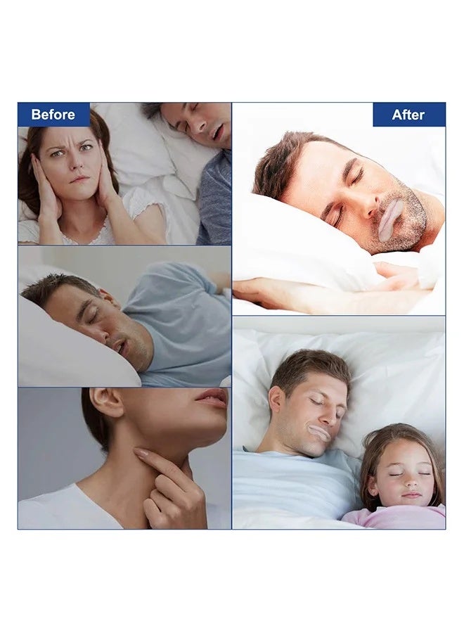 Elaimei Sleep Strips for Mouth Breathing - 90PCS Anti-Snoring Tape with Breathing Vent, Medical-Grade Adhesive for Better Sleep - Image 5